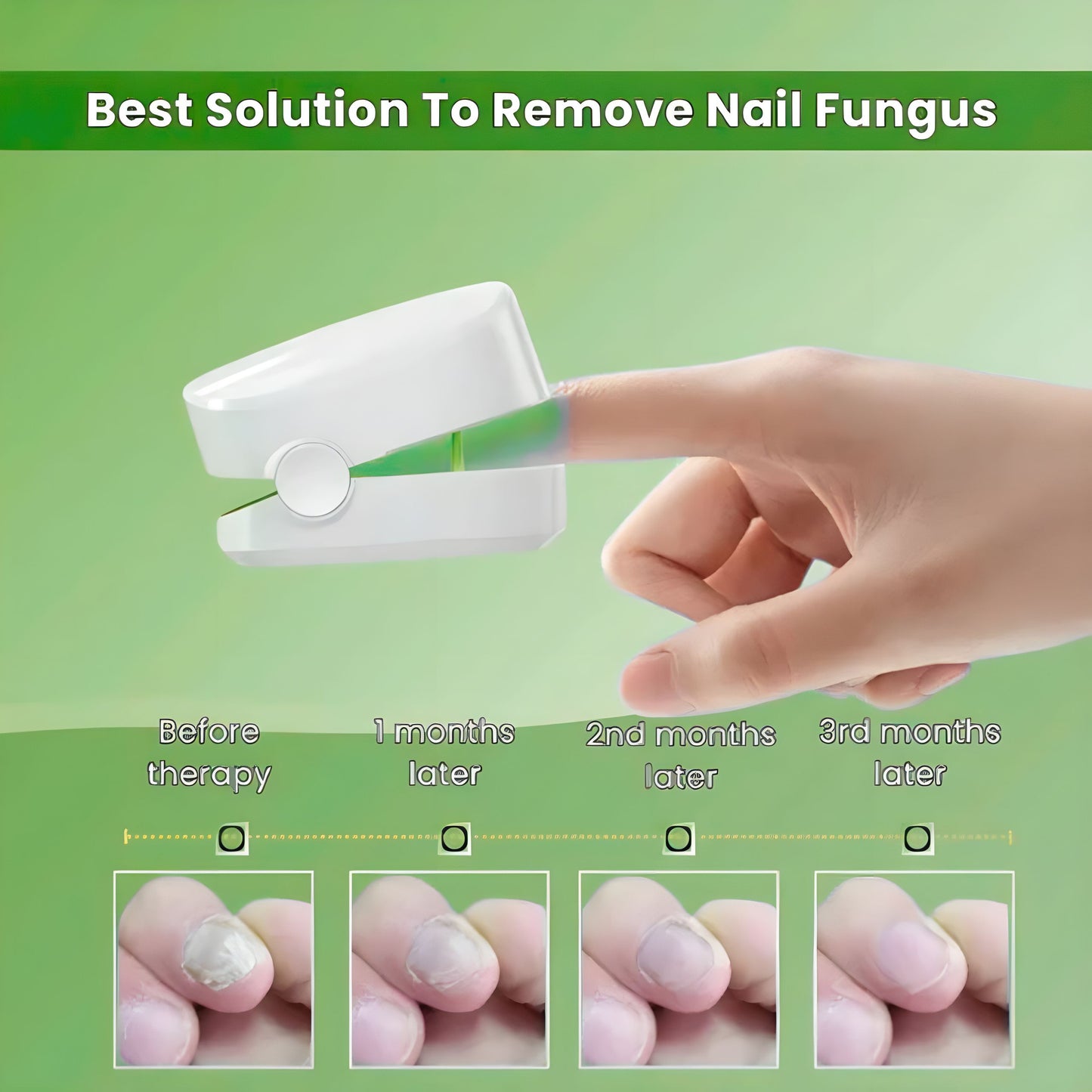 ClearToez™ | Nail Fungus Laser