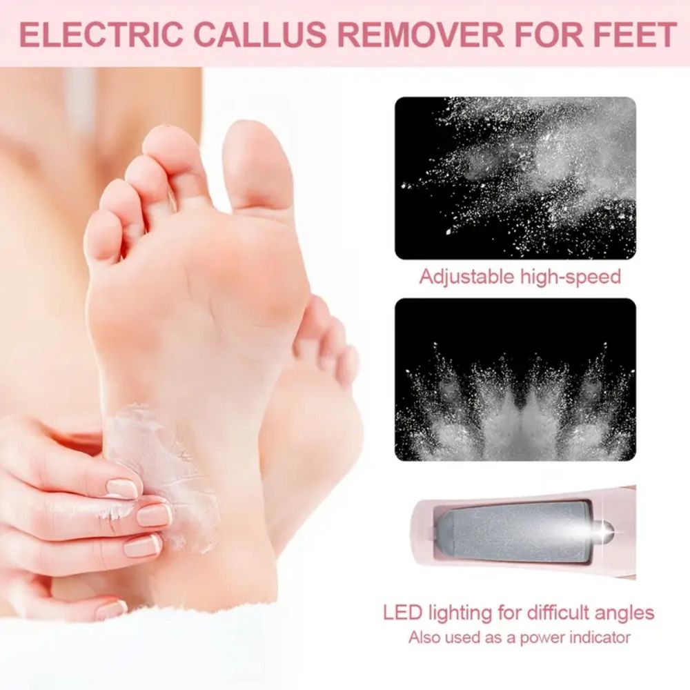PediLuxe™ | Electric Callus Remover