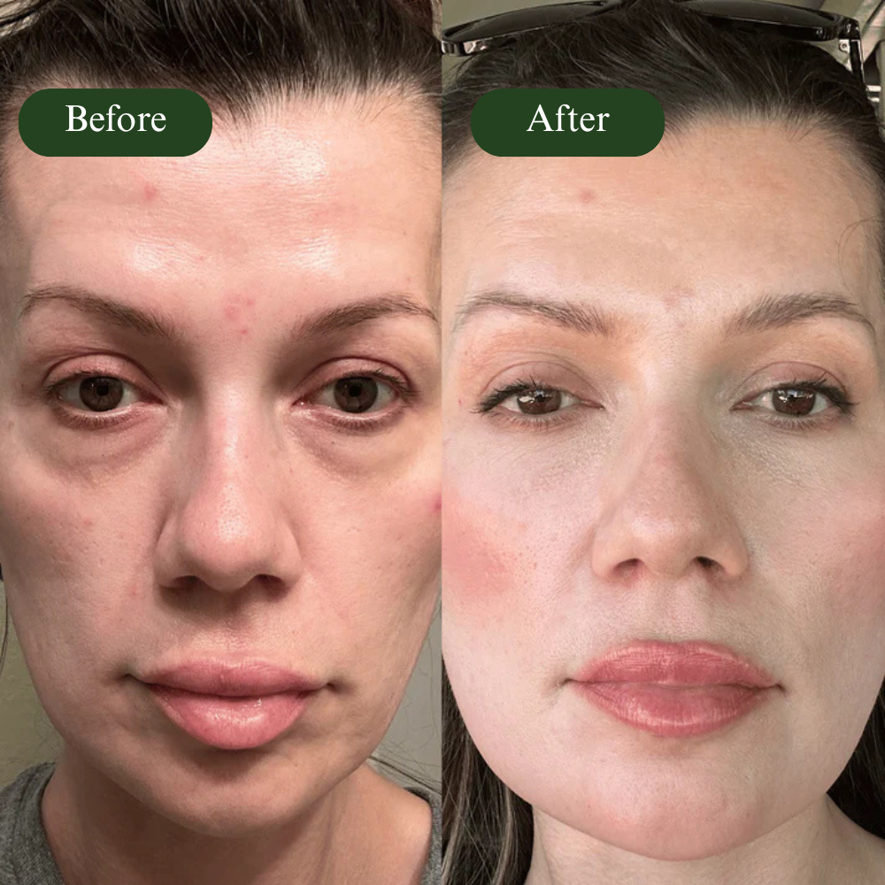 AuraEyes™ | Under-Eye Red Light Therapy