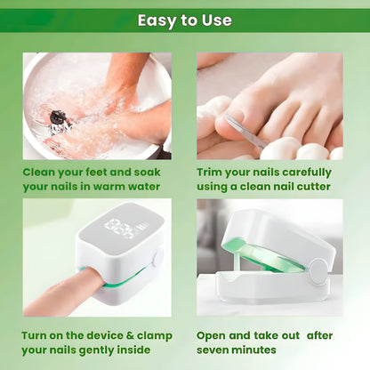 ClearToez™ | Nail Fungus Laser