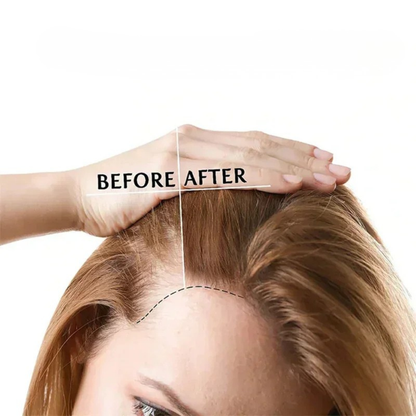 LumiHeal™ | Red Light Cap